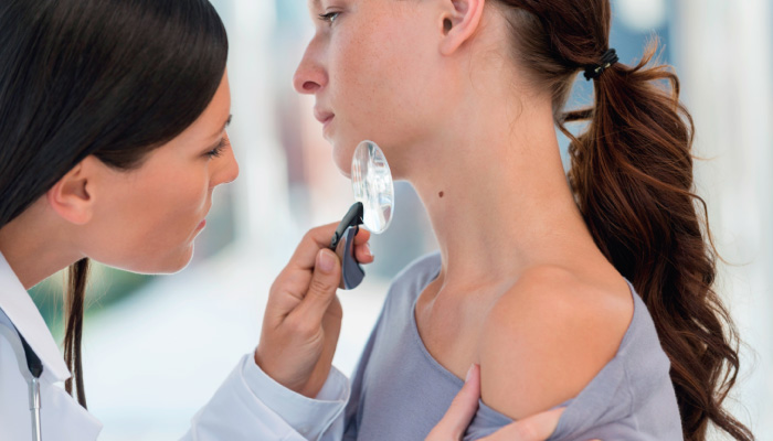 dermatolog papilom